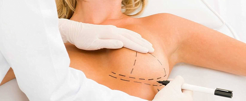 Breast Reduction تصغير الثدي