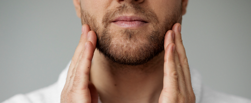 Beard Transplant زراعة اللحية