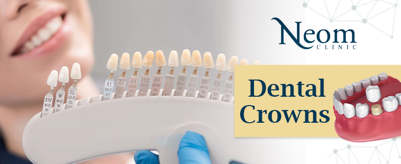 Dental Crowns تيجان الأسنان