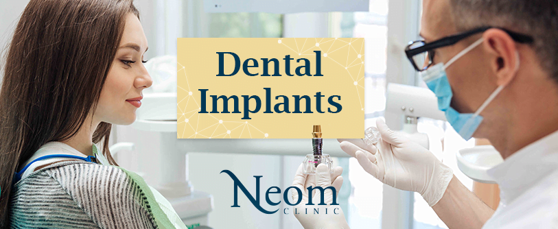 Dental Implants زراعة الأسنان