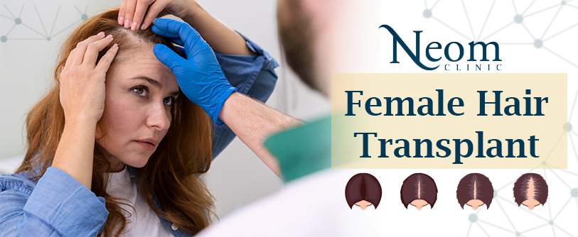 Say Goodbye to Thinning Hair with Female Hair Transplant at Neom Center ...