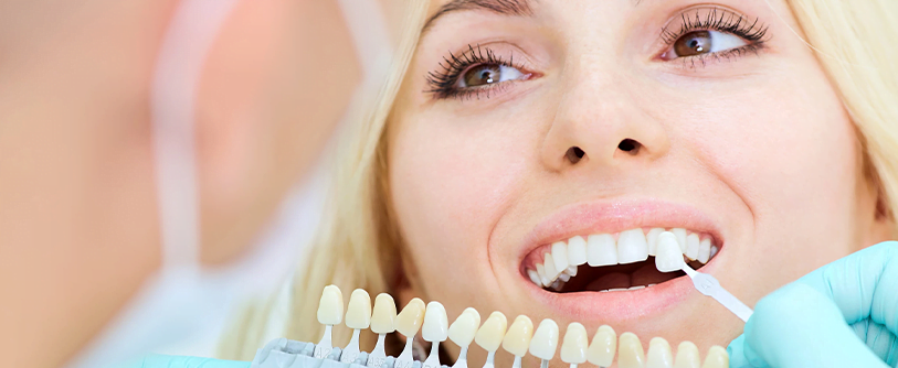 Dental Veneersفينير الأسنان 